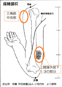 予防接種（皮下）の部位